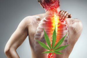 Marijuana to treat back pain
