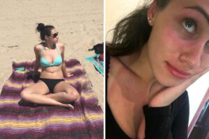 Anxiety Around Skin Health